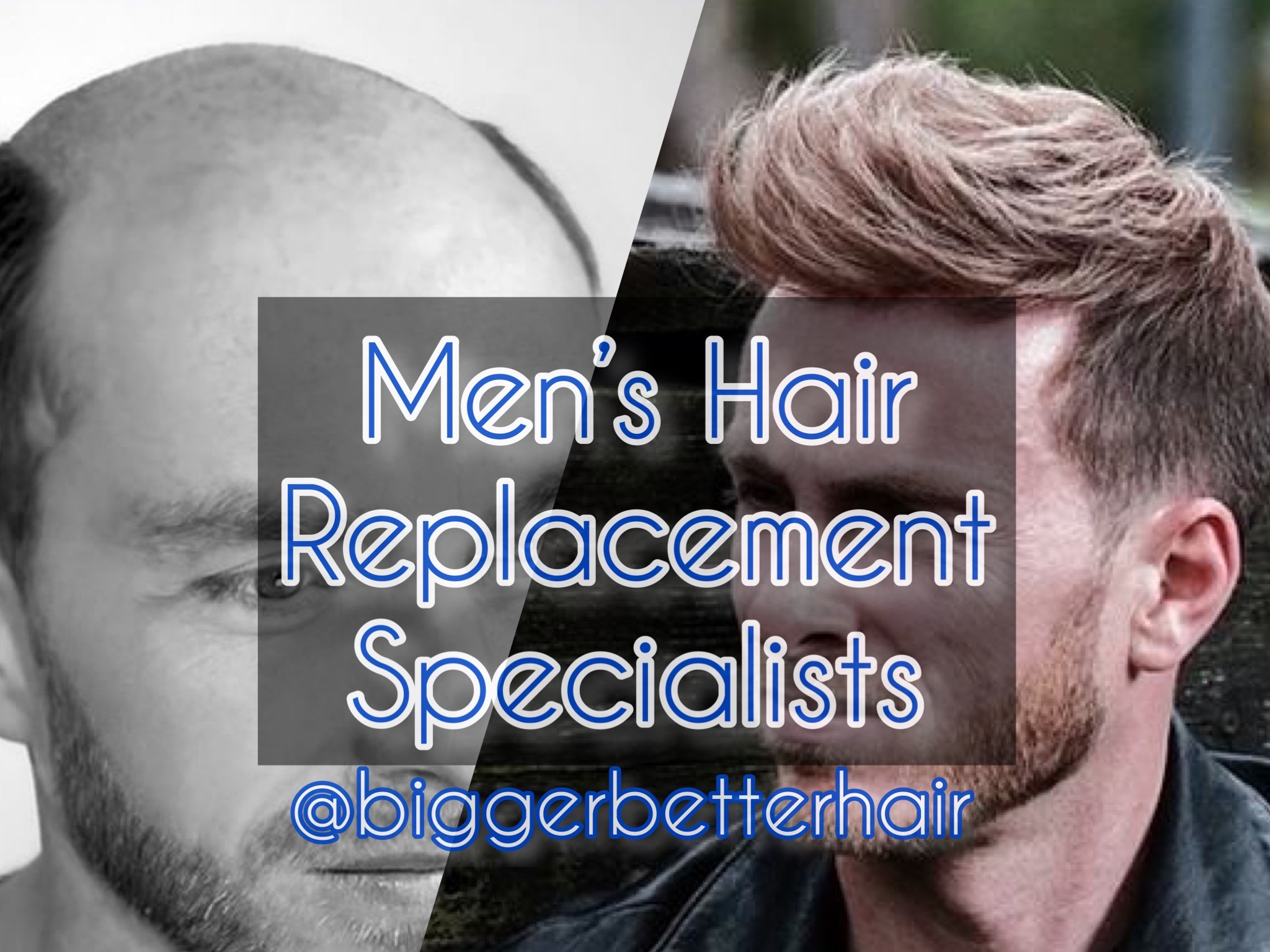Men's Hair Replacement Services Near Me in Dallas | BBH